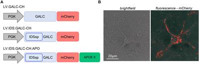 In vitro Validation of Chimeric β-Galactosylceramidase Enzymes With Improved Enzymatic Activity and Increased Secretion